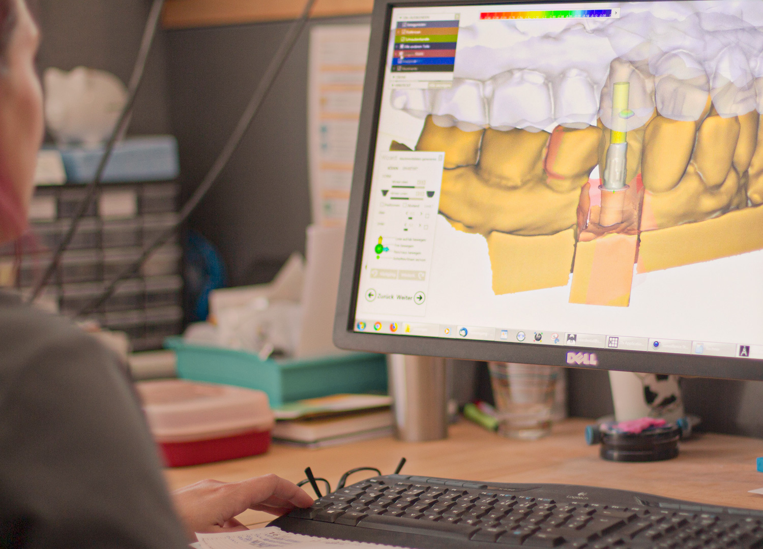 Inter-dental - 3D-Scanner auf dem neuesten Stand der Technik