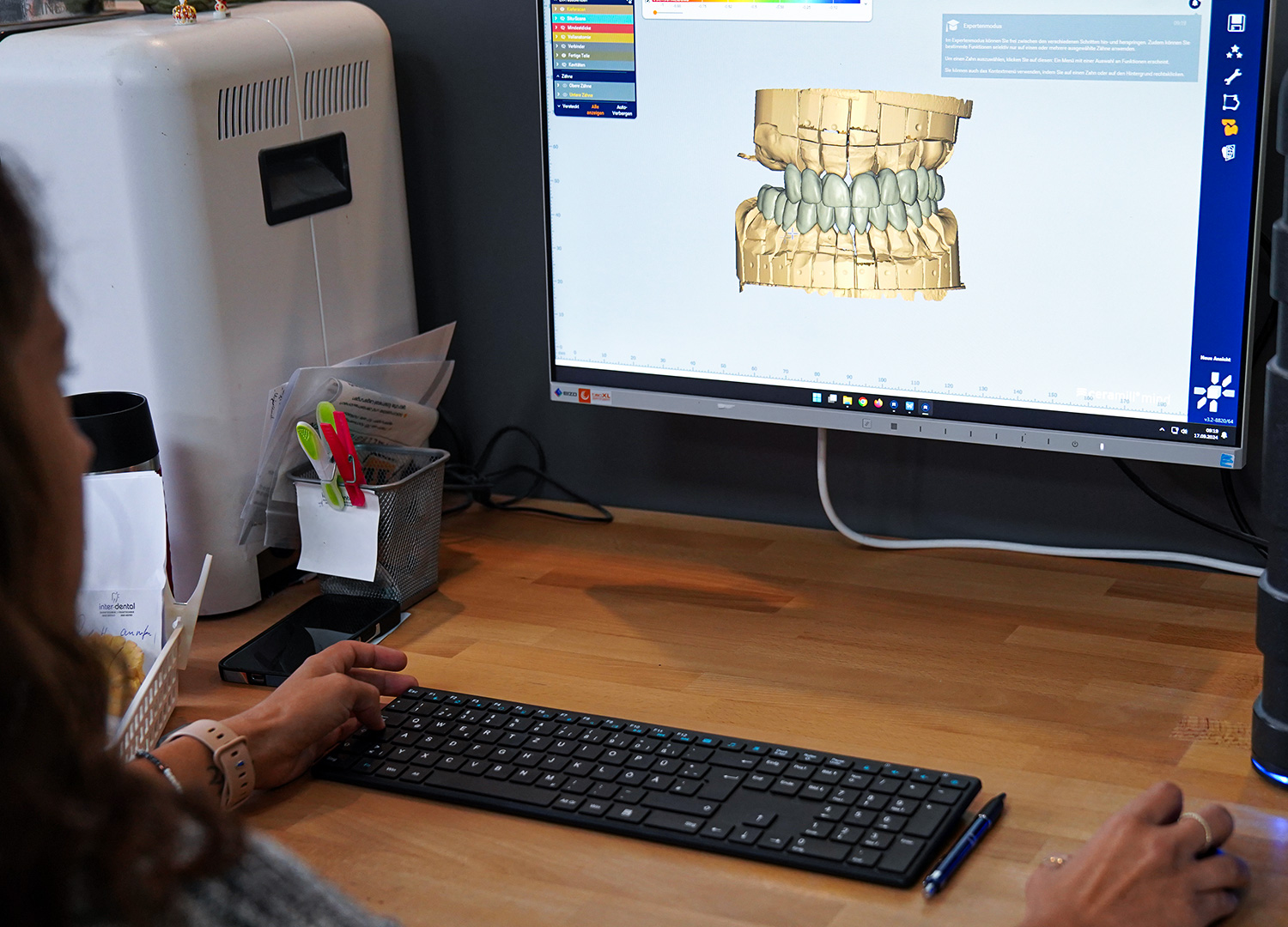 Inter-dental - 3D-Scanner auf dem neuesten Stand der Technik